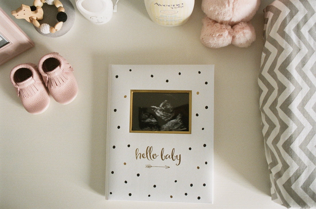 Polka dot baby memory book with sonogram, pink baby shoes, and plush toy on a nursery table